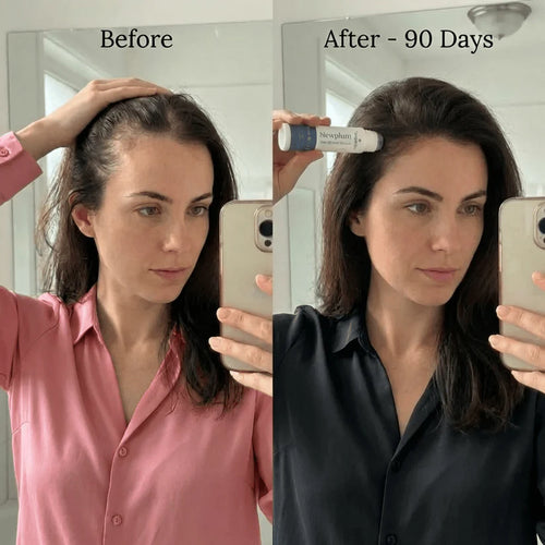 newplum-hair-growth-serum