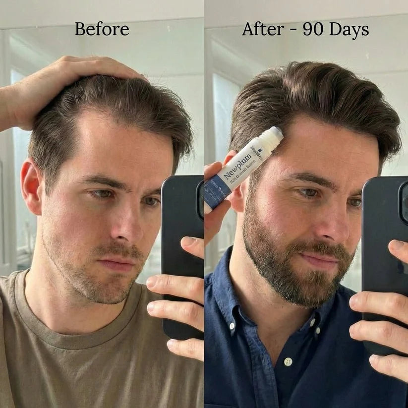 newplum-hair-growth-serum